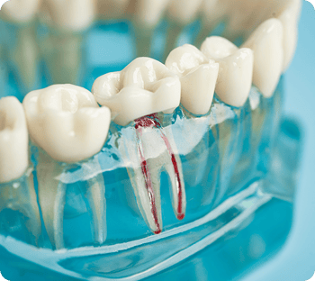 A transparent tooth model, showing the teeth root canals.