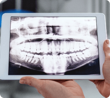 A dentist holding a tablet with a dental x-ray on the screen.