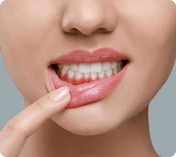 A woman pullng her lip down to reveal red, inflamed gums.