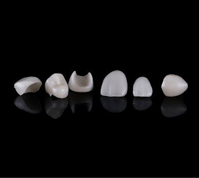 Close up of porcelain veneers on a black background.