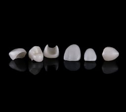 Close up of porcelain veneers on a black background.