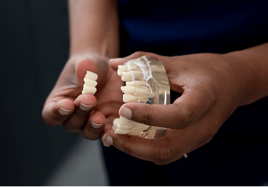 Close up of Dr. Diluni holding teeth models, showcasing what a dental bridge looks like.