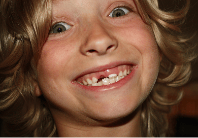 Smiling kid with a missing front tooth.