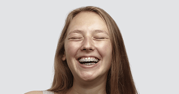 Laughing girl with braces.