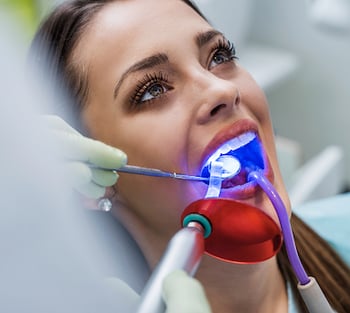 Close up of a patient getting dental bonding.