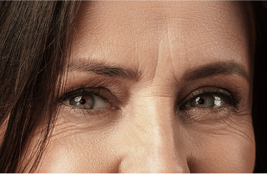 Close-up of the frown line wrinkles in between the eyes.