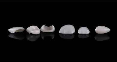 Close up of porcelain veneers.