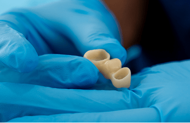 Close up of Dr. Diluni holding a dental bridge.
