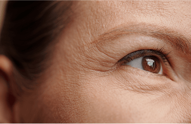 Close-up of crow's feet wrinkles around a woman's eyes.