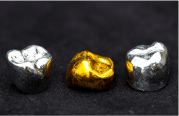 Close up of gold and silver dental crowns.
