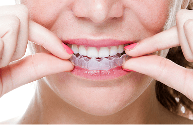 Close up of a woman inserting a clear aligner, an orthodontic treatment option to help correct a gummy smile caused by tooth positioning.