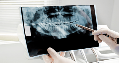 Dentist pointing at a panoramic dental X-ray that displays the full upper and lower jaw in a single image.