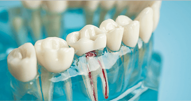 A transparent tooth model, showing the teeth root canals.