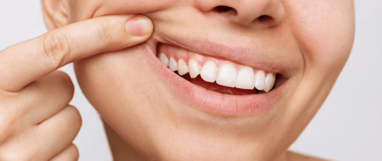 A woman pulling up her upper lip to reveal healthy gums.