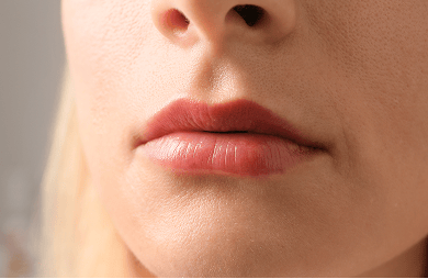 Close up of a woman’s lips, representing lip repositioning surgery to reduce upper lip movement and minimise gum visibility when smiling.