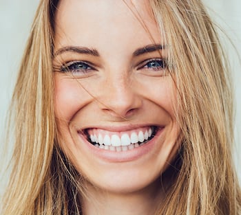 A woman with a "gummy smile" - a smile with excess gum visible.