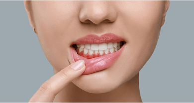 A woman pullng her lip down to reveal red, inflamed gums.
