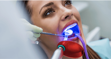 Close-up of a patient's mouth with a curing light applied during a dental bonding procedure.