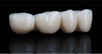 Close up of a dental bridge on a black background.