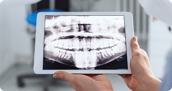 Dentist holding a tablet with a dental x-ray on the screen.