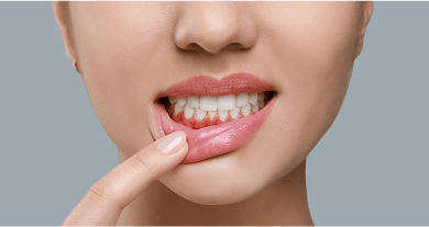 A woman pulling down her bottom lip to reveal reddened gums, illustrating the signs of gum disease.