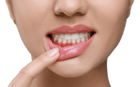 A woman pulling down her bottom lip to reveal reddened gums, illustrating the signs of gum disease.