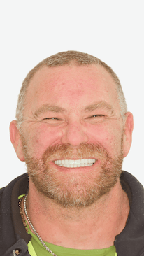 Thumbnail of a Mulgrave Dental Group patient talking about how their life changed and their self confidence improved after getting All-On-4 dental implants.