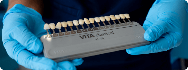 VITA Classical Shadeguide