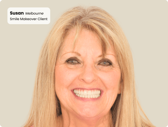 Smile makeover patient at Mulgrave Dental Group, beaming with confidence and showcasing a full set of natural-looking, beautifully restored teeth.