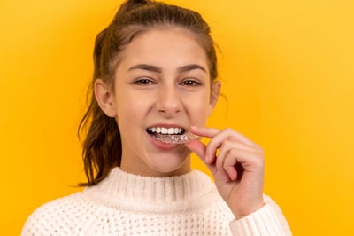 Image of a young girl with a clear aligner.