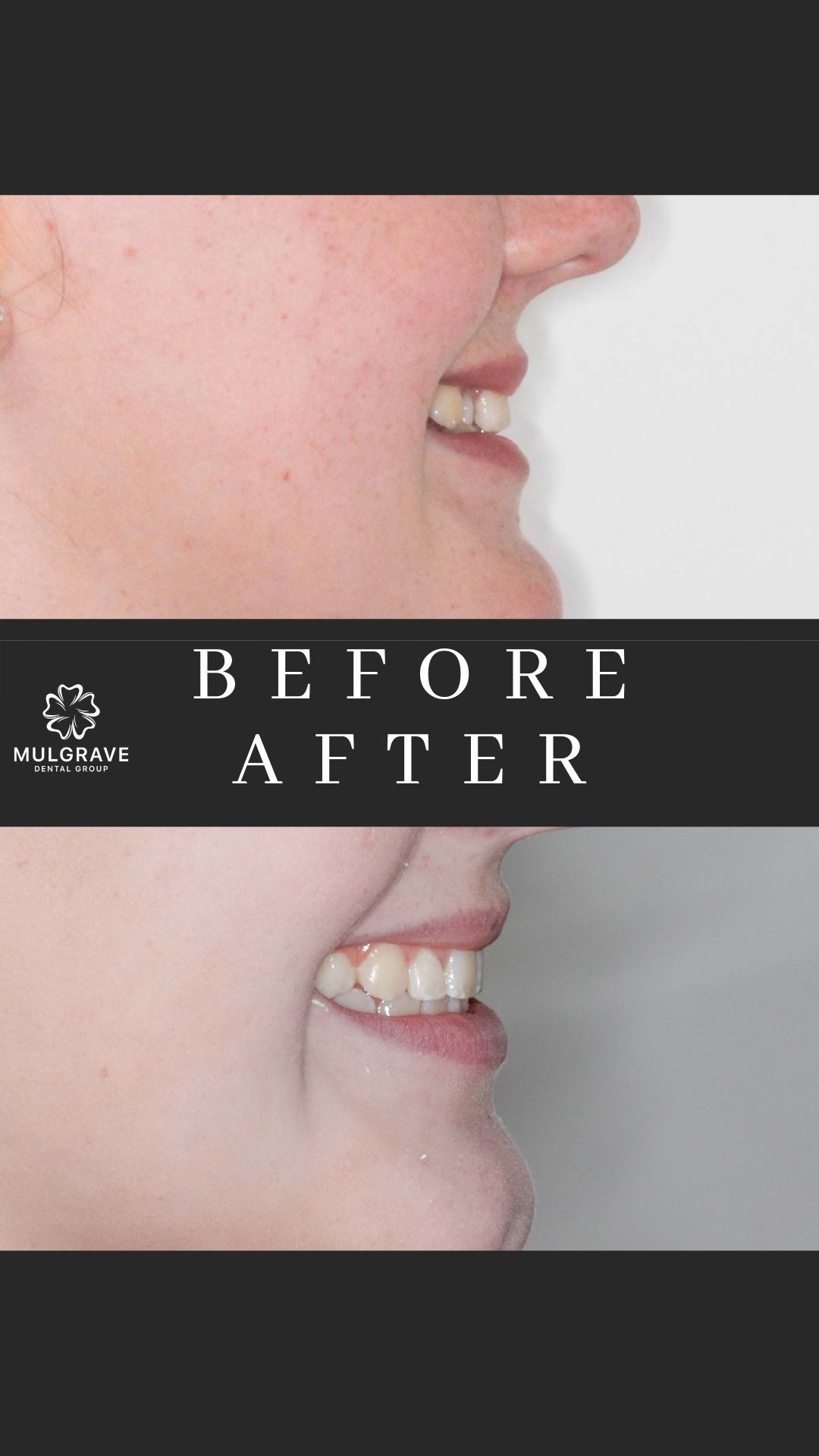 MDG Ortho Before After KAT001