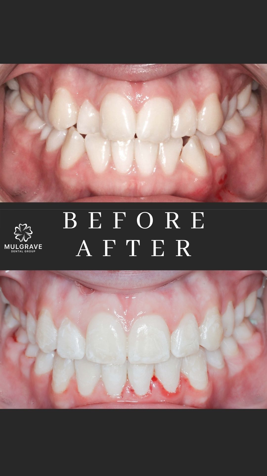 MDG Ortho Before After KAT002