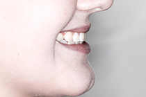 ORTHO3_AFTER