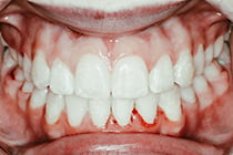 ORTHO4 AFTER