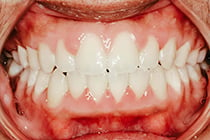 ORTHO5 AFTER