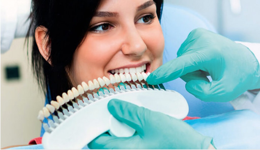 Difference Between Veneers And Crowns